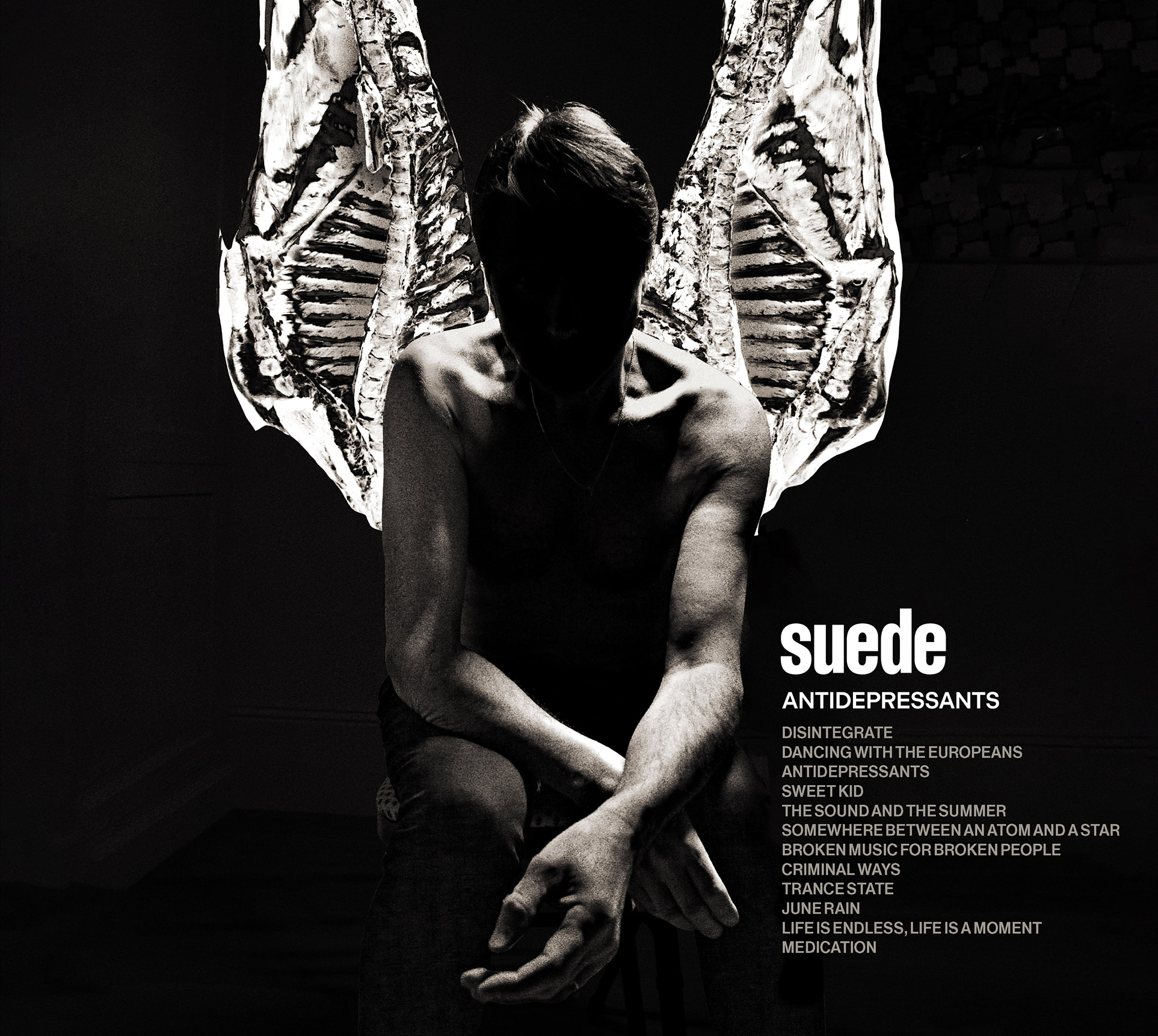 激レア　Suede Live DVD スウェード Amazon.co.jp: Suede: Deluxe Edition: ミュージック
